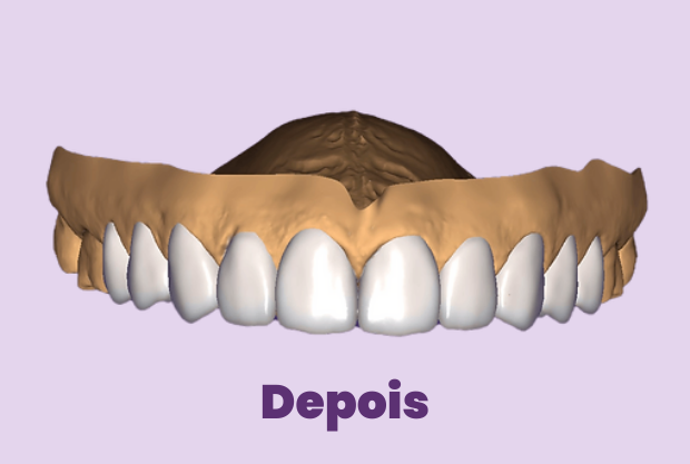 Depois